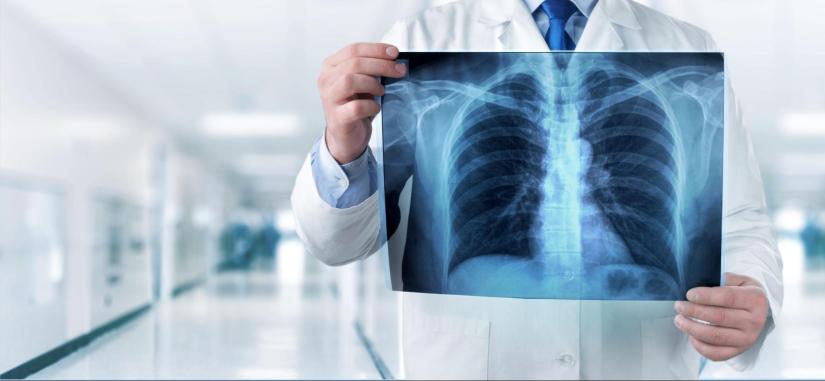   Advanced Lung Cancer Surgery and Treatment Options at Geetanjali Hospital, Udaipur